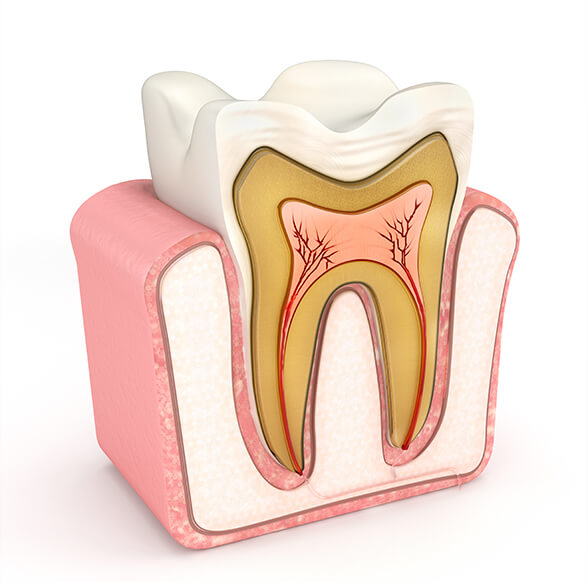 extractions1 - Optima Dental Spa